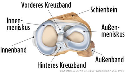 beschriftetes Schema der Minisken im Knie