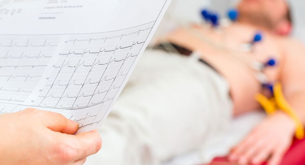 Durchführung eines EKG