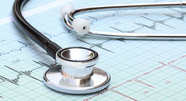 Stethoskop liegt auf EKG-Ausdruck