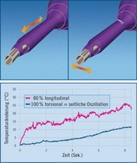 Phakoemulsifikationsgerät mit seitlicher Ultraschall-Oszillation