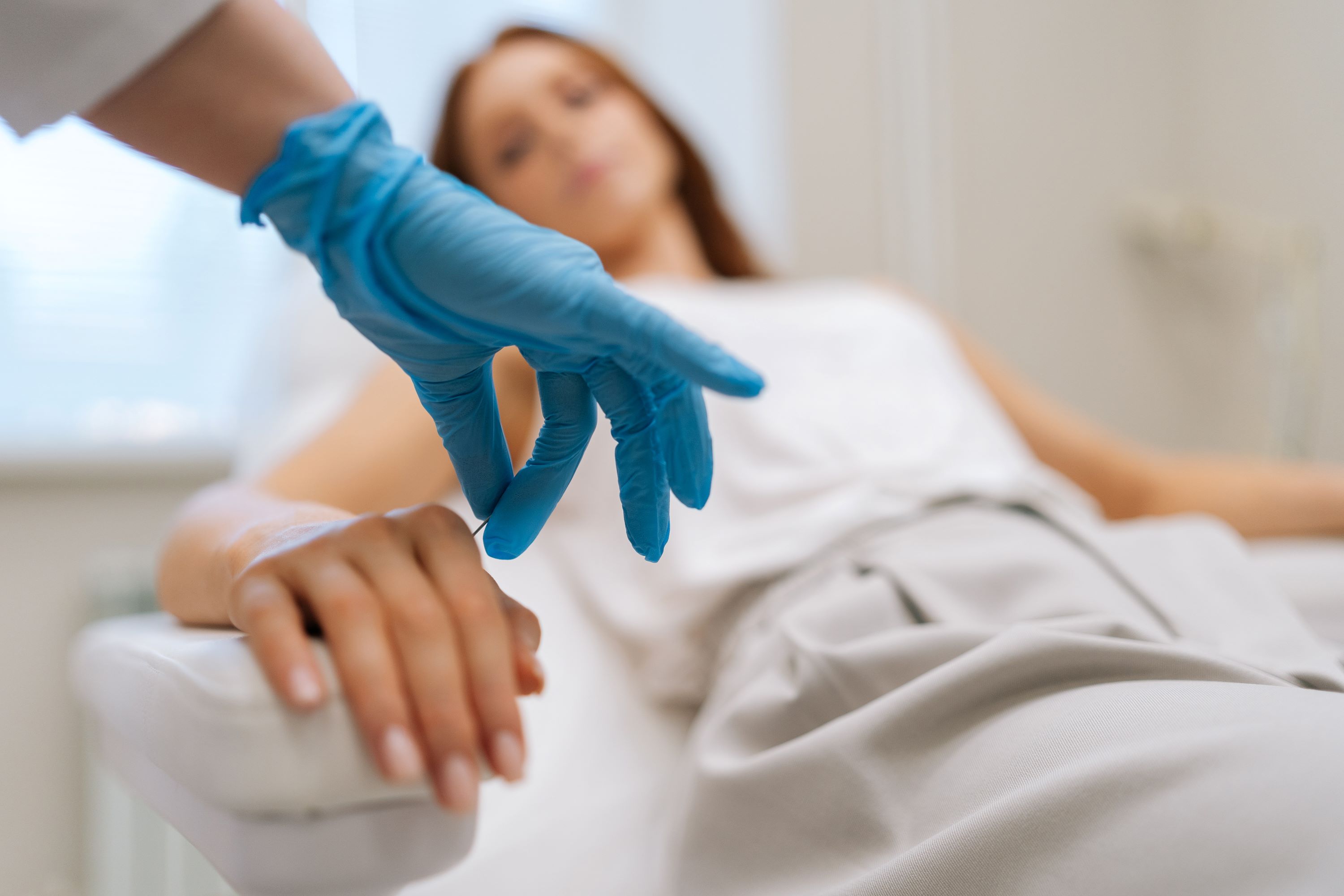 Akupunktur-Behandlung