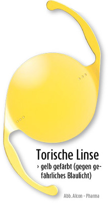 Torische Linse